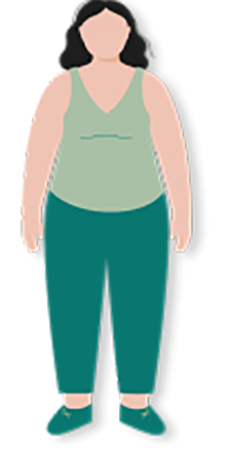 Béo phì cấp độ 2